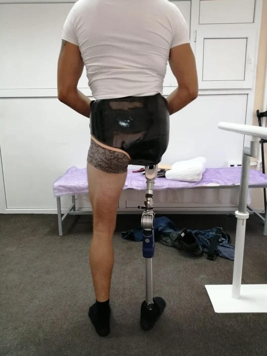 Modular Hip Disarticulation Prosthesis