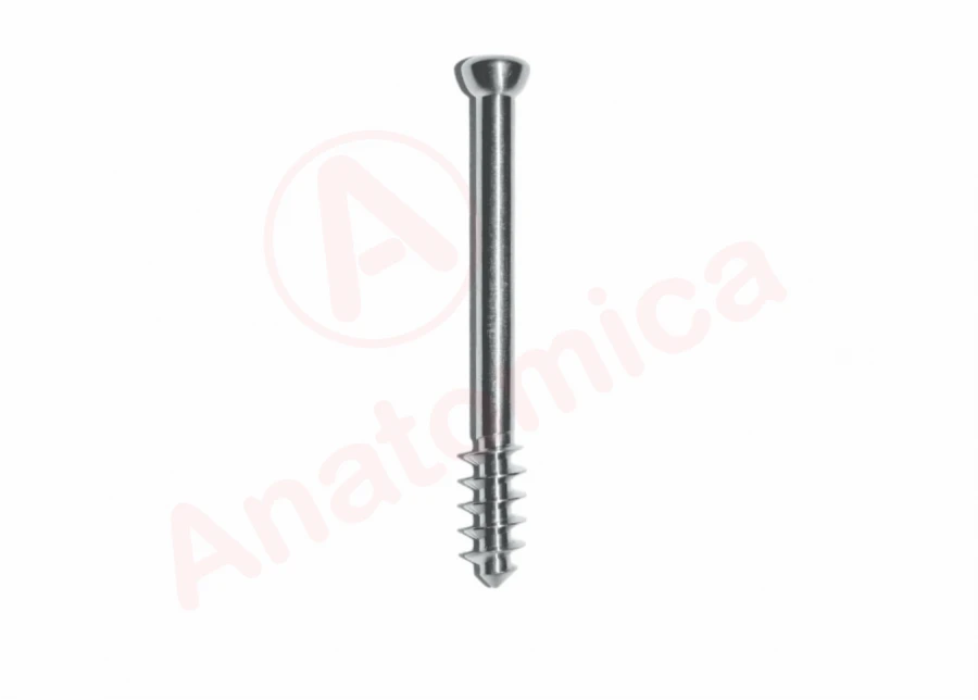 Spongy Screw for Bone Fracture Fixation, 16mm