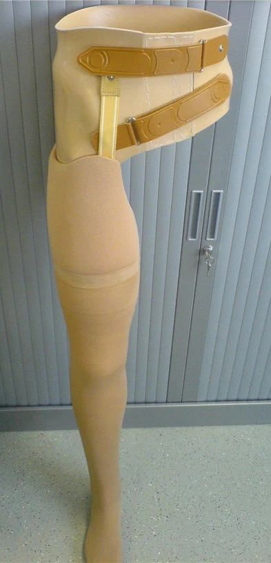 Modular Hip Prosthesis PN8-M for Hip Disarticulation