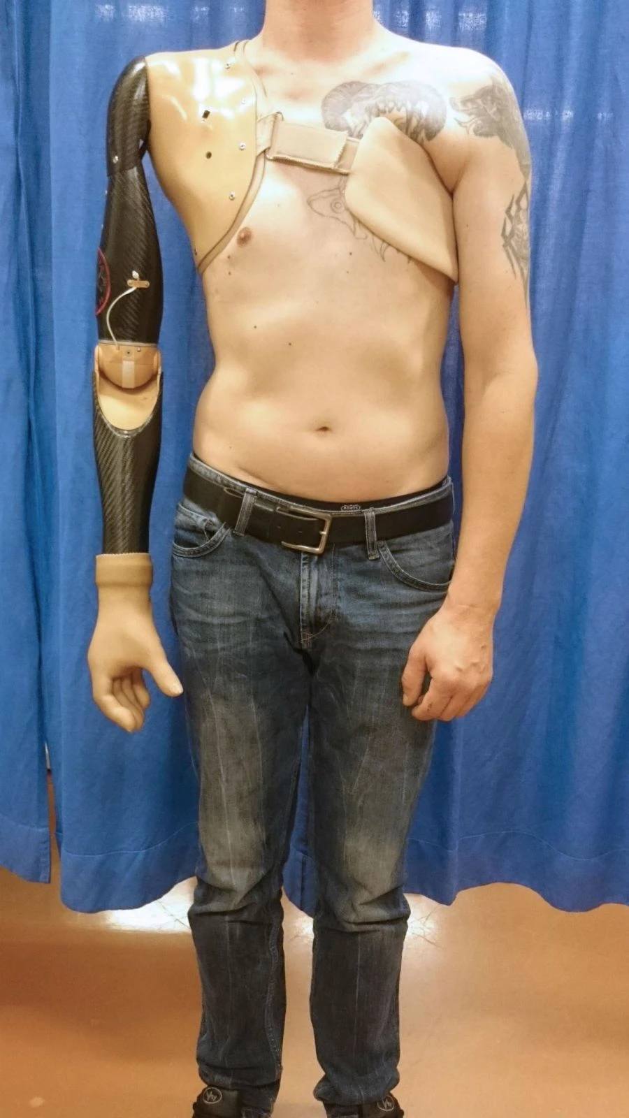 Electromechanical Shoulder Prosthesis with Contact Control System
