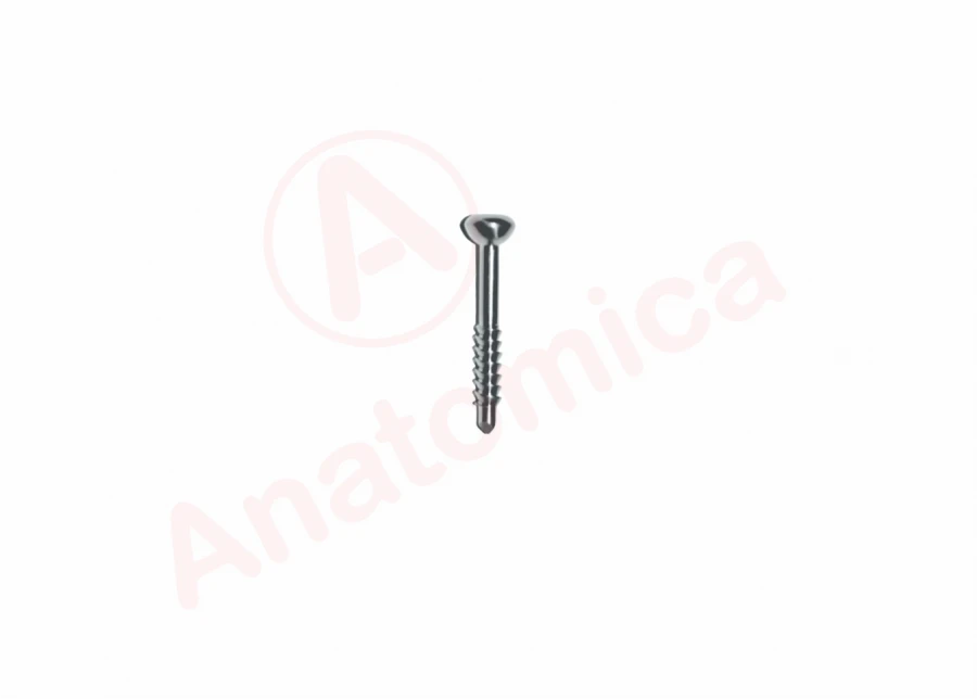 Malleolar Screw for Bone Fracture Fixation
