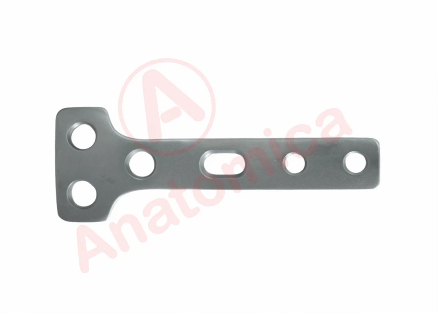 T-Shaped Bone Plate for Fracture Stabilization