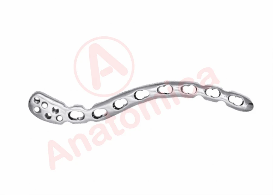 S-Shaped Plate with Lateral Expansion and Angular Stability for Bone Fractures