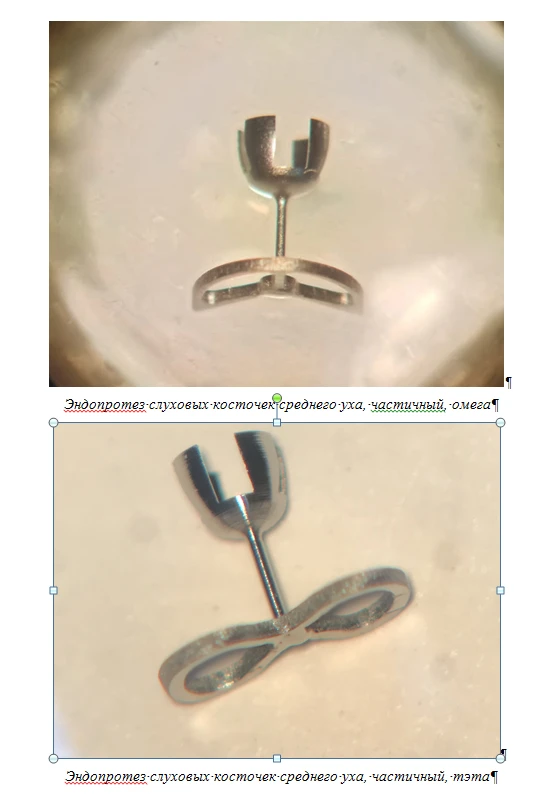 Middle Ear Sound Conduction Prostheses, ESC-"KONMET", Partial Model TU 32.50.22-030-11458417-2021