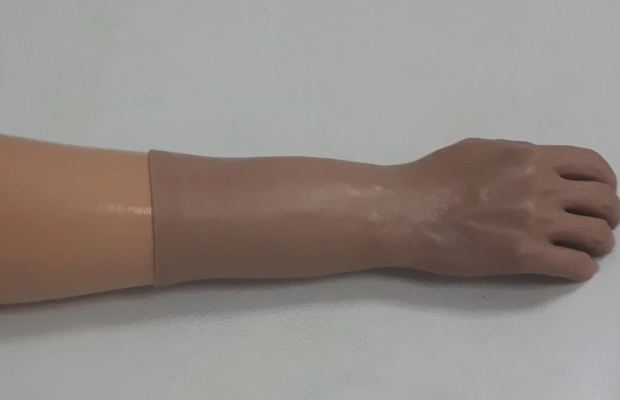Cosmetic Forearm Prosthesis for Functional Use