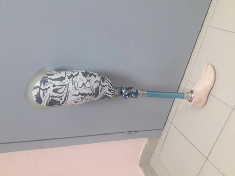 Bathing Prosthesis for Hip, Custom Socket