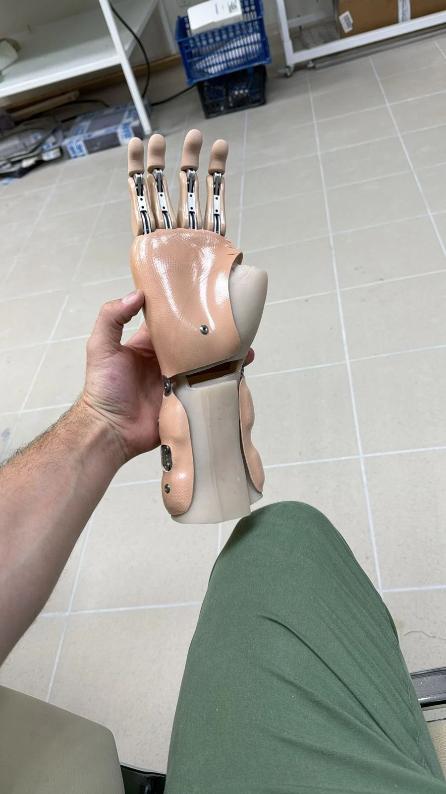 Active Hand Prosthesis (Traction) for Partial and Complete Amputation