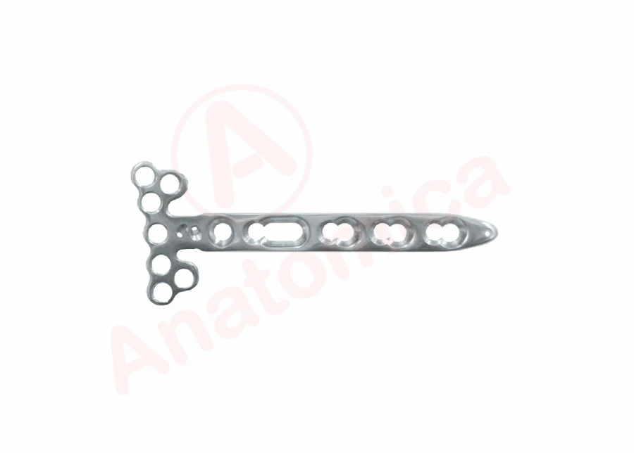 LTM Plate with Angular Stability and Limited Contact