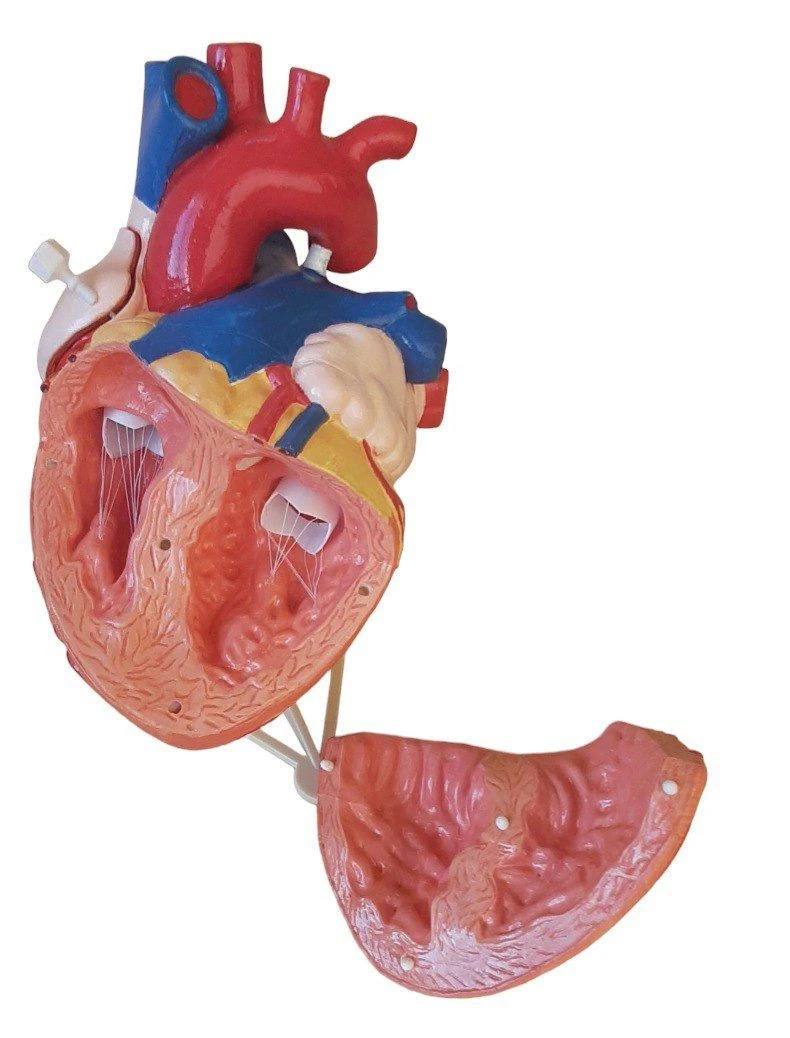 Enlarged Heart Model 2:1, ROST-heart