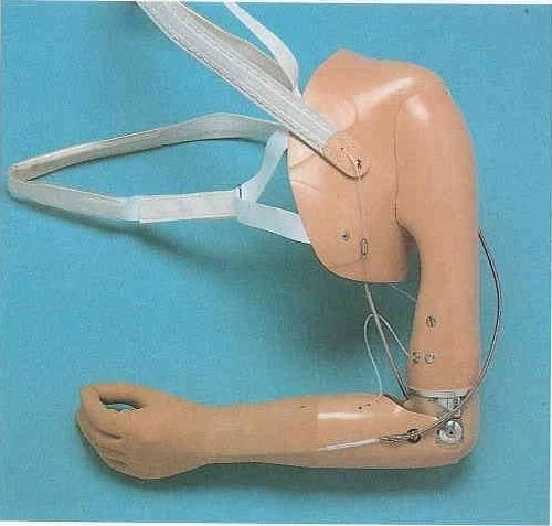 Electromechanical Shoulder Prosthesis with Control System PR8-VK-OK