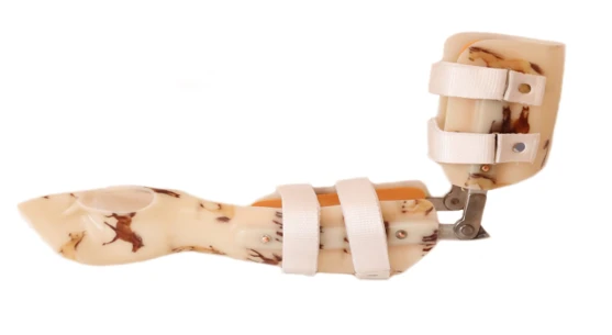 Orthopedic Upper Limb Device for Amputees and Congenital Defects