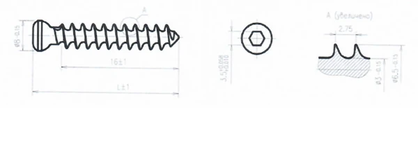 Solid Threaded Titanium Alloy Spongy Screw 6.5mm 55mm
