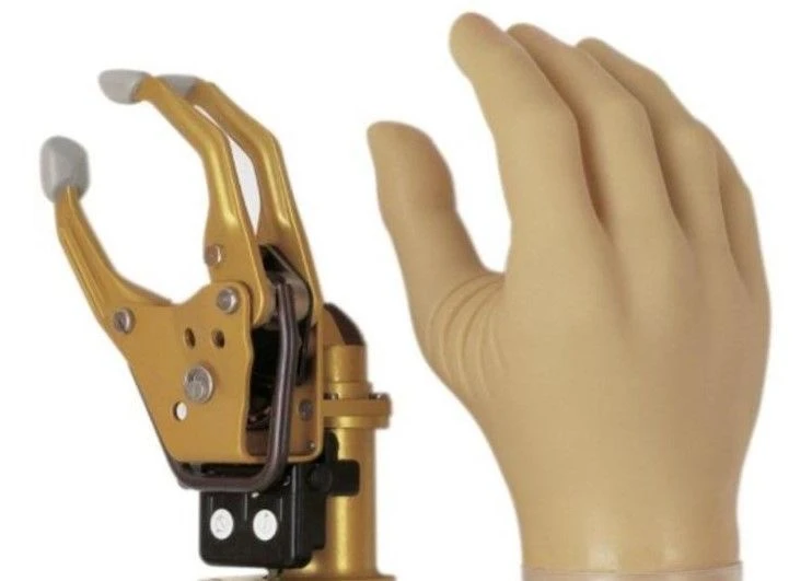 Energy-Powered Hand Prosthesis for Partial and Complete Hand Amputation PR0-23B1