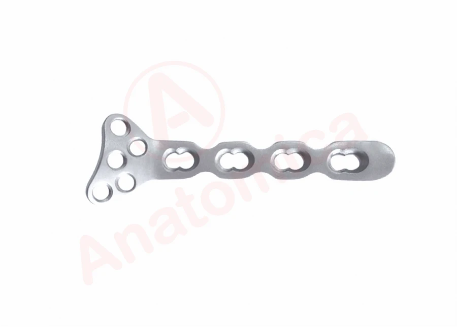 Distal Radius Bone Plate with Angular Stability