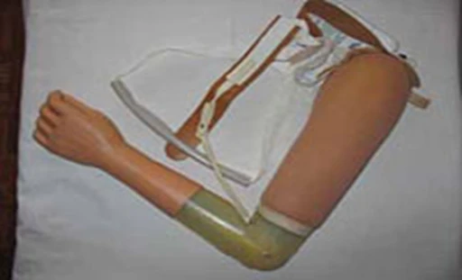 Active Traction Arm Prosthesis - Universal Upper Limb Solution