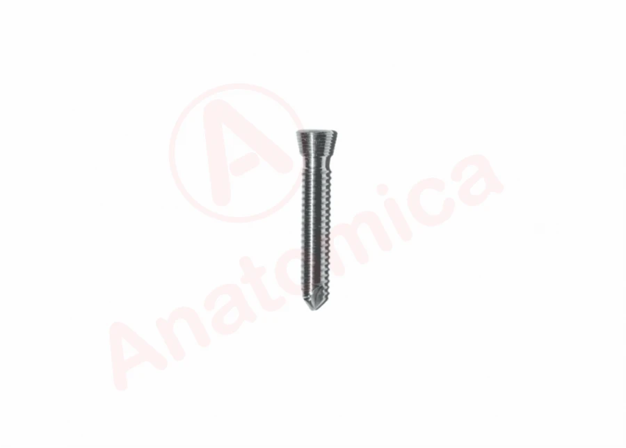 Cortical Screw with Conical Thread for Bone Fracture Fixation