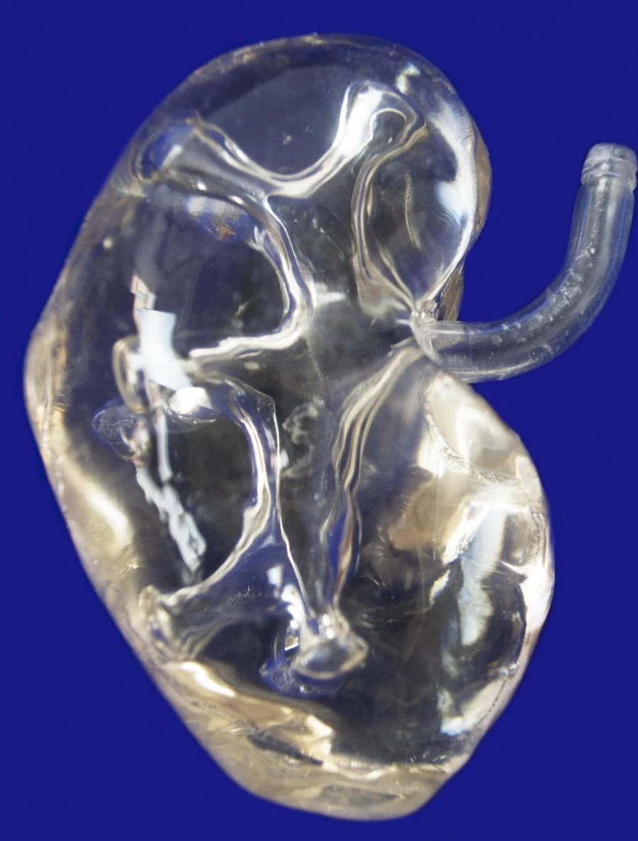 Transparent Kidney Model for Blood Vessel and Nerve Structure, 14008