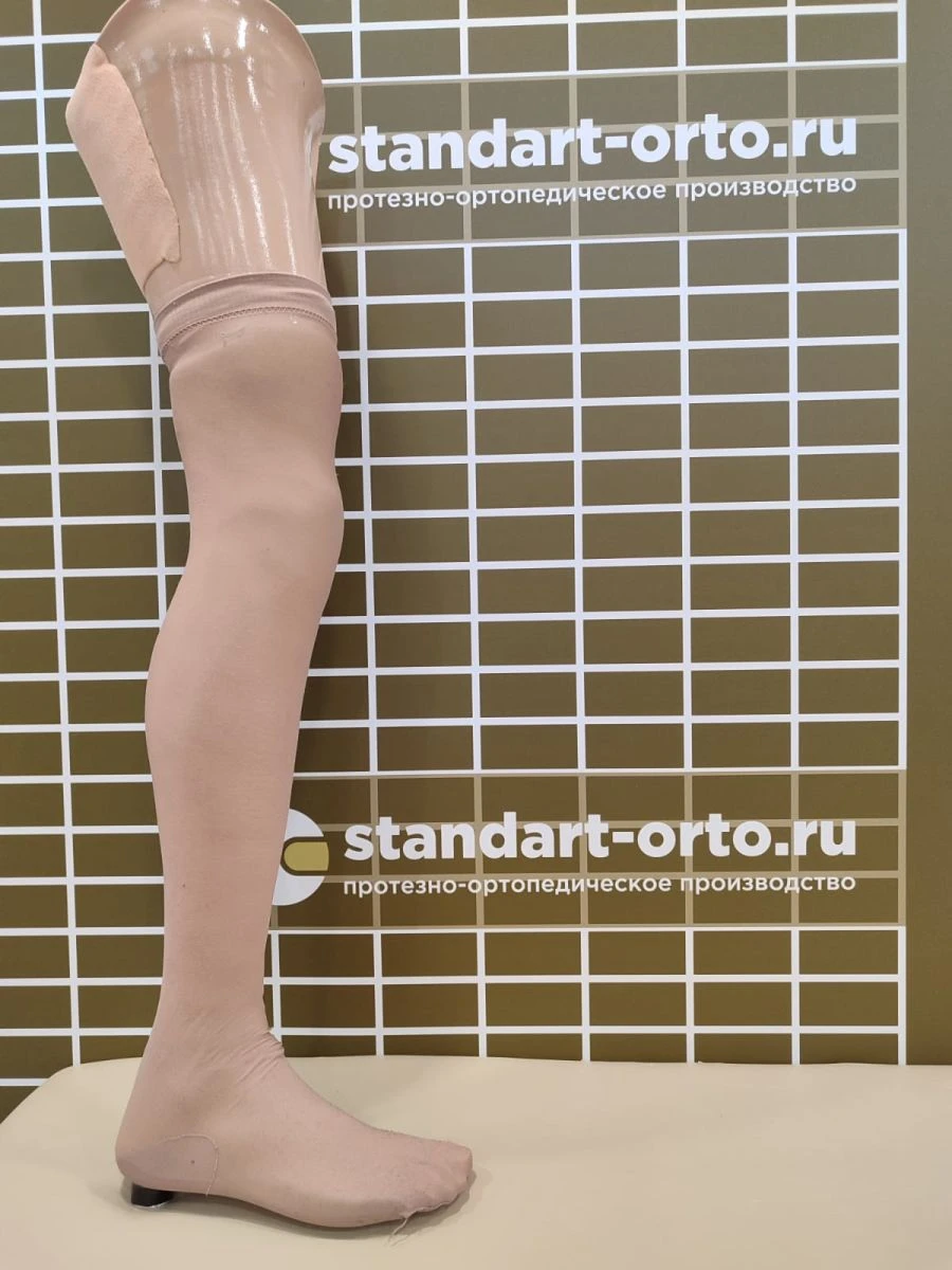 Modular Hip Prosthesis for Congenital Underdevelopment