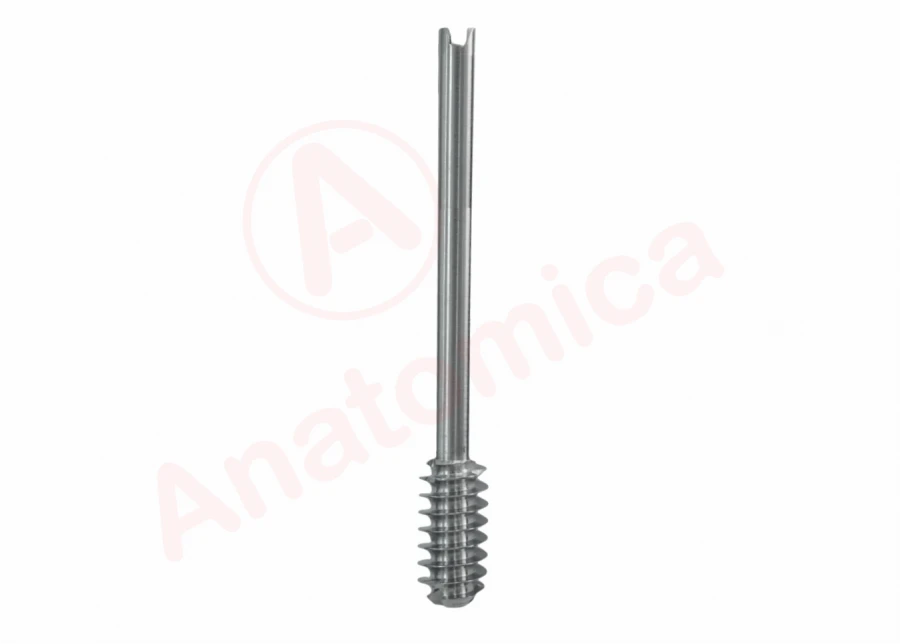 Dynamic Bone Screw for Fracture Stabilization