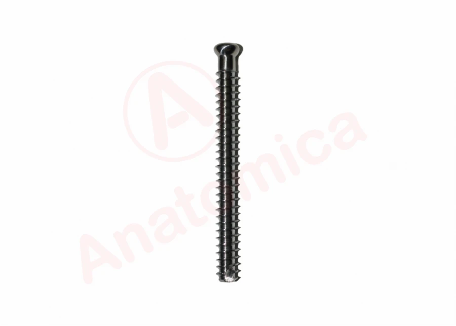 Solid Thread Canulated Screw for Bone Fracture Fixation