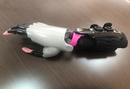 Active Hand Prosthesis for Partial Limb Reconstruction