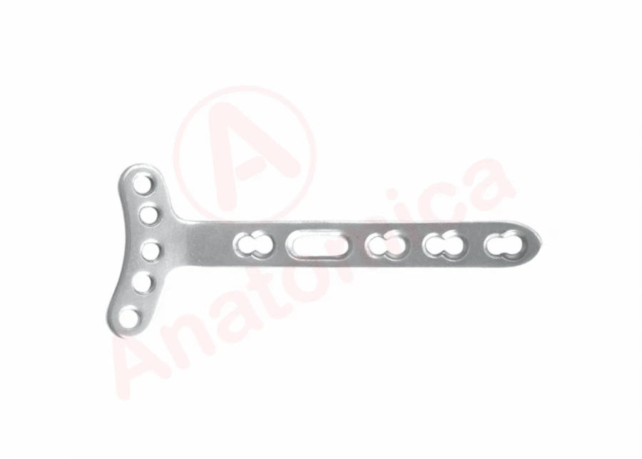 T-Shaped Plate with Angular Stability and Limited Contact