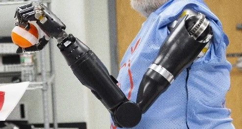 Electromechanical Shoulder Prosthesis with Control System