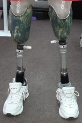 Modular Lower Leg Prosthesis for Partial Development Cases