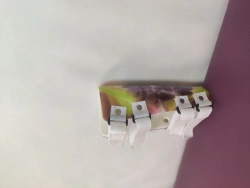 Custom Forearm Brace AR5-01 for Rehabilitation