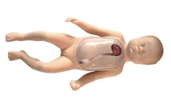 Life-Size Newborn Model for Central and Peripheral Venous Catheterization L67B