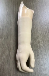 Cosmetic Forearm Prosthesis for Functional Rehabilitation