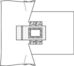 Surgical Field Limiting Sheet with Cutouts for Urological Cystoscopy Procedures