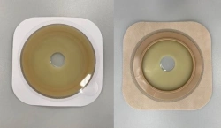 Stoma Rehabilitation Product for Colostomy, Ileostomy, and Urostomy: Flat and Convex Plates