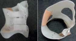 Functional Correction Corset for Spinal Alignment