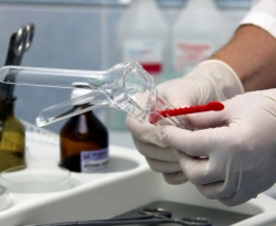 Disposable Sterile Vaginal Mirrors S by ZVK-DiaKlon