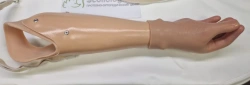 Active Forearm Prosthesis (Tensile Type)