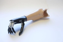 Microprocessor-Controlled Forearm Prosthesis