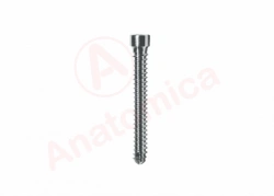 Distal Locking Screw for Bone Fractures