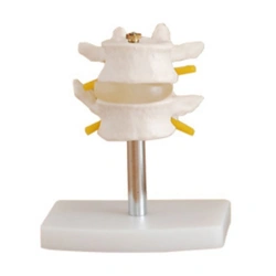 Lumbar Vertebrae Model with Intervertebral Disc and Spinal Cord, 11109-1
