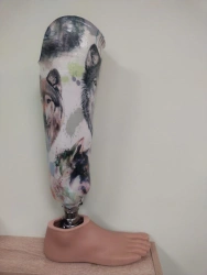 Modular Lower Leg Prosthesis for Underdevelopment Cases