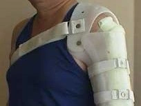 Shoulder Joint Orthopedic Device for Stabilization and Correction