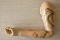 Microprocessor-Controlled Arm Prosthesis Model MCP-2023