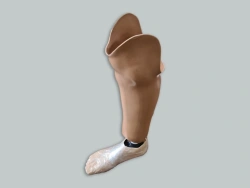 Modular Below-Knee Prosthesis for Underdevelopment Cases