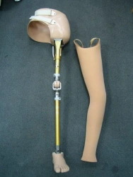 Modular Prosthesis for Hip Disarticulation