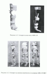 Orthopedic Device for Lower Limbs and Body AN8-119 NKT