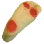Diabetic Foot Model, Art. S19