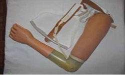Active Shoulder Prosthesis (Tensile Type)