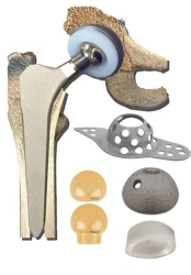 Hip Joint Endoprosthesis Model TU 32.50.22-020-49346483-2017