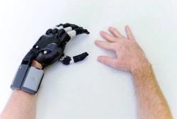 Microprocessor-Controlled Prosthetic Hand