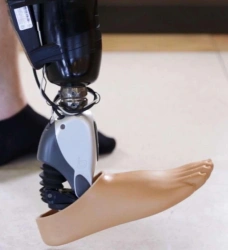 Lower Limb Prosthetics